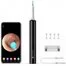 Умная ушная палочка Xiaomi Bebird Smart Visual Spoon Ear Stick C3 Black 1